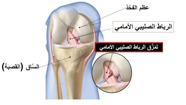 الدكتور هيثم عبد المنعم  استشاري جراحة العظام والمفاصل وإصابات الملاعب