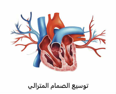 الدكتور ابراهيم مدين جراحة الأوعية الدموية